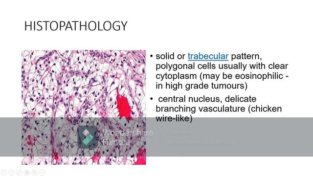 Histopathology of rhinosporidiosis,clear cell renal cell carcinoma