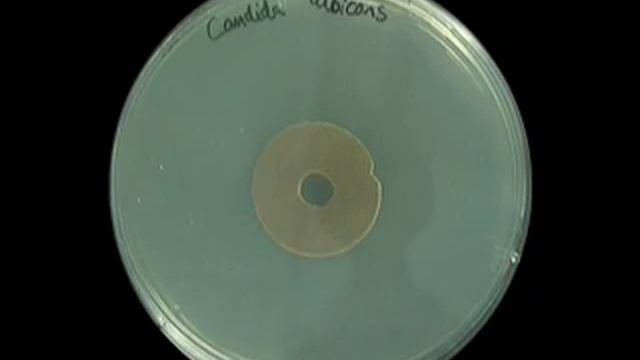 Candida albicans - Zonex
