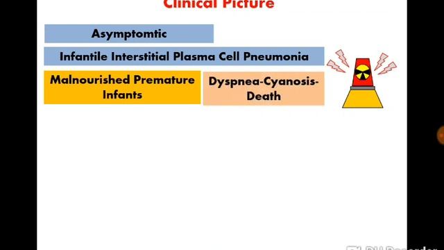 8. Pneumocystis carinii المتكيسة الرئوية