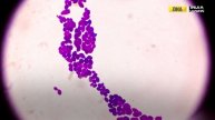 Rare and deadly fungal infection spreading across U.S. | Candida auris | DNA India