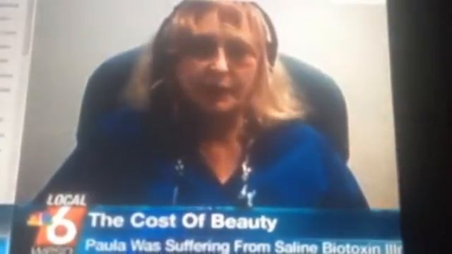 Breast implant illness