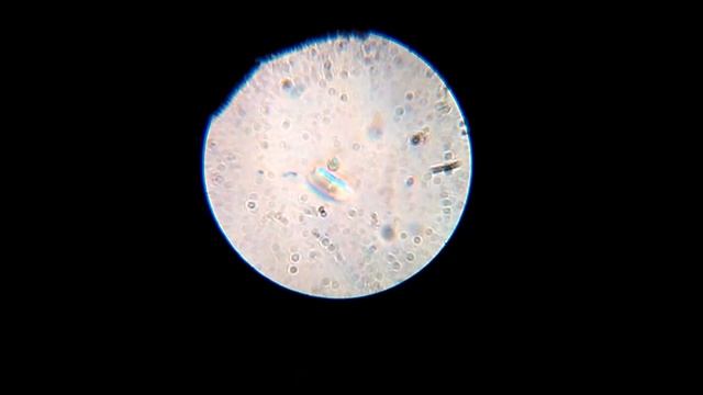 Rhizophydium cyclotellae