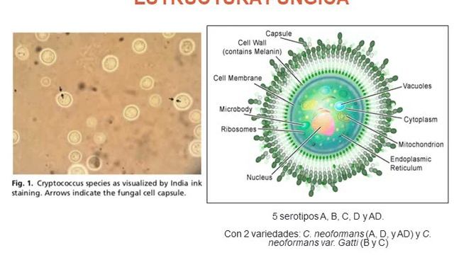 Infecciones del SISTEMA NERVIOSO producidas por Virus de la rabia y Cryptococcus neoformans
