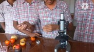 Temporary slide preparation of Rhizopus||Science is life||
