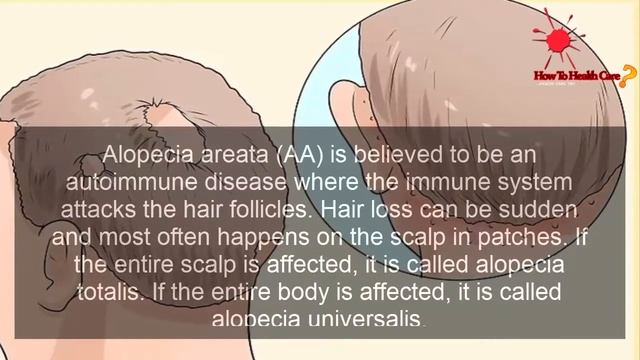 How To Stop Hair Loss With Natural Remedies - Identifying Causes Of Hair Loss - Method 1
