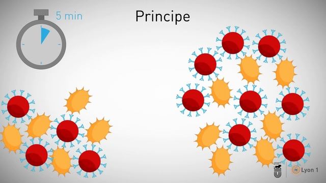 Candida Krusei : Identification de la levure par test d'agglutination