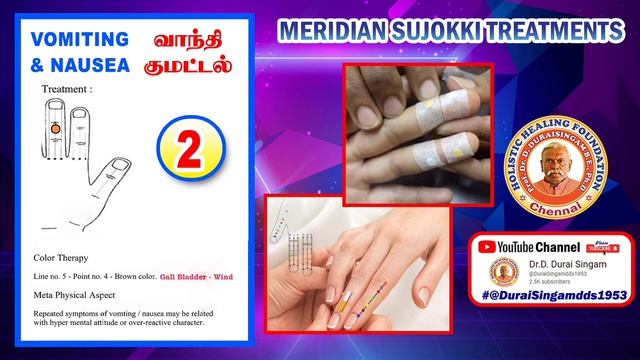 2 .VOMITING & NAUSEA -MERIDIAN SUJOKKI TREATMENT