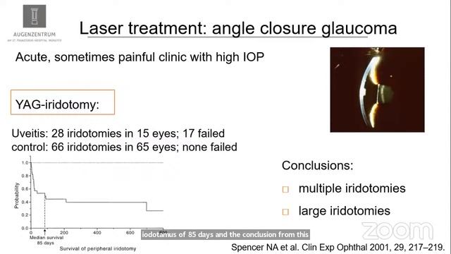 Uveitis webinar 30