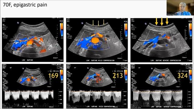 KimSH NCS Doppler, Technical tips, WFUMB 2022, Romania