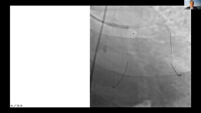 Webinar: TCT 2020 Update