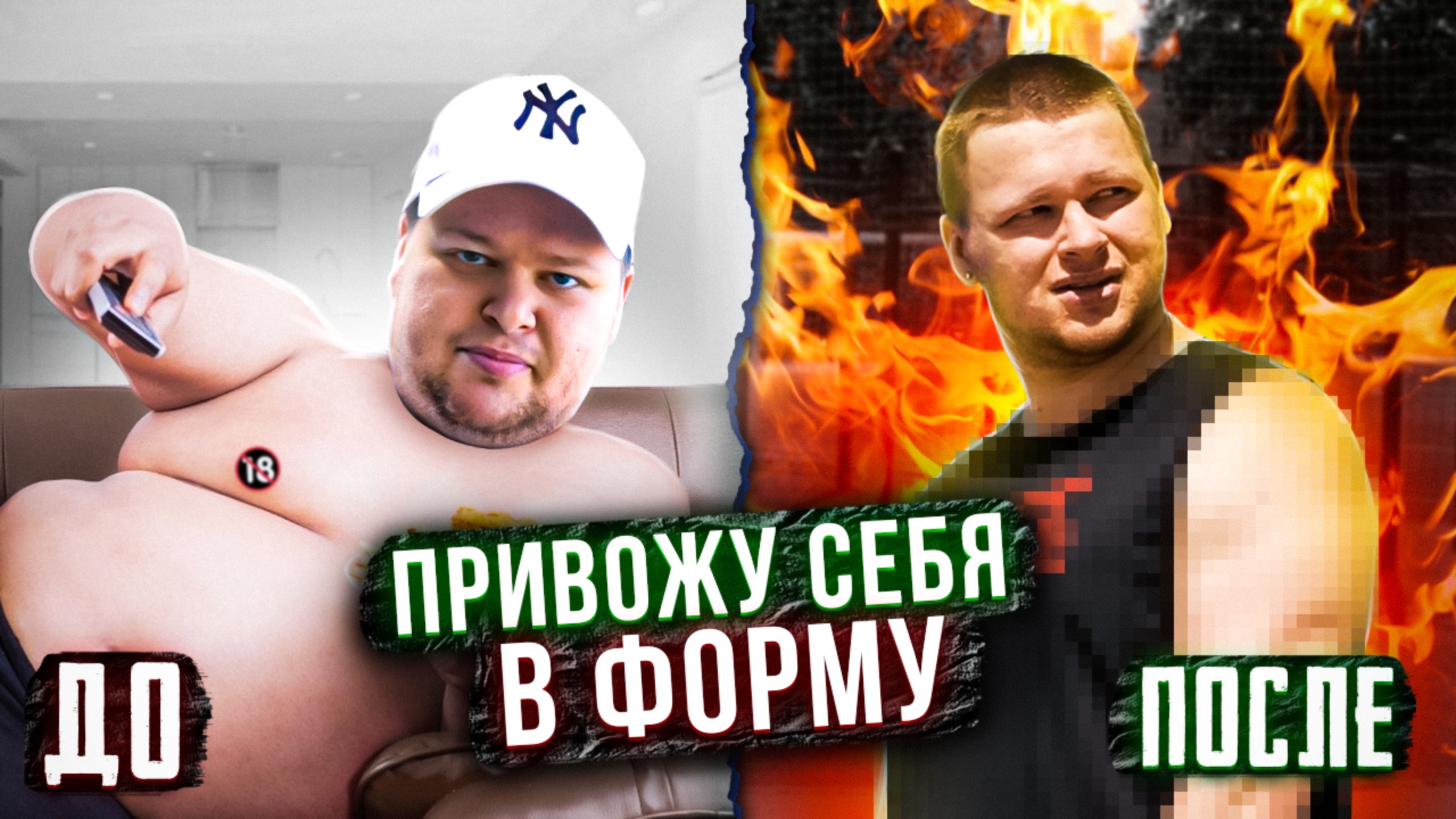 передний вис