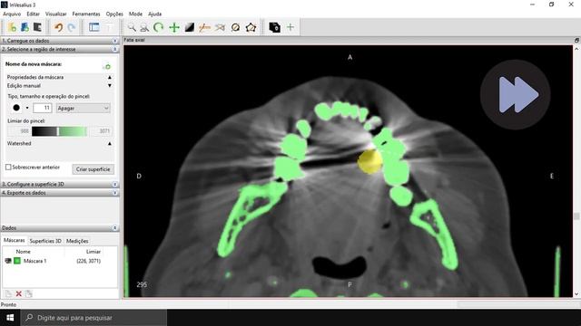 InVesalius - Tutorial 3 - Segmentação Manual