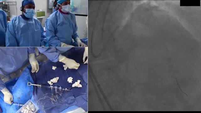 Live Case 7 - LAD CTO Bifurcation