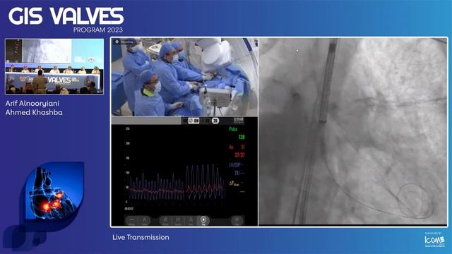 26  Live Transmission   Arif Alnooryiani, UAE   Ahmed khashsaba , UAE  Alqassimi Hospital Sharjah