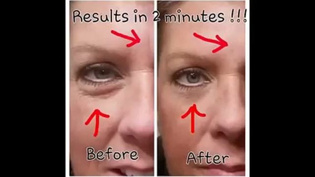 Instantly Ageless Результаты До и После