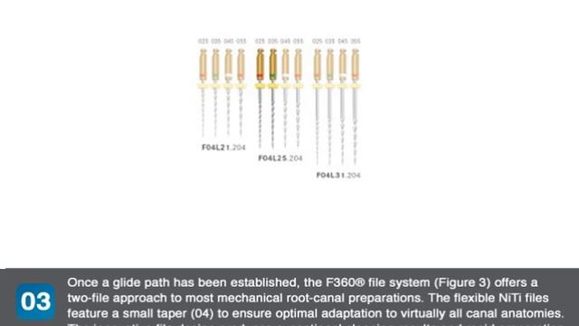 How to shape and clean root canals with Komet® endodontic instruments