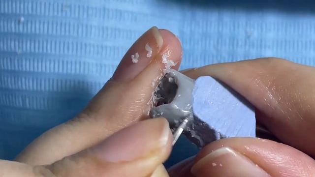Wax up upper first premolar