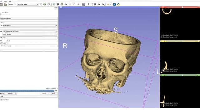 3D Slicer 4 8 1 2018 08 28 16 01 46