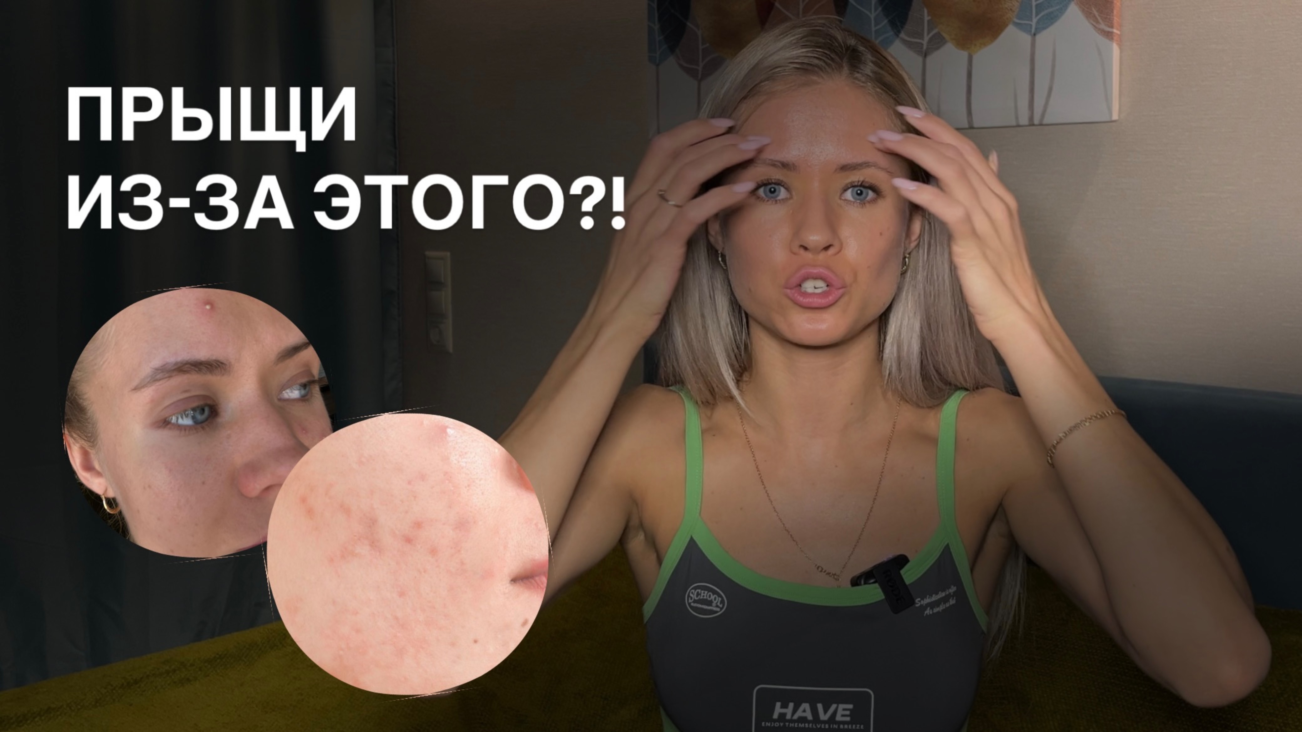 Как избавиться от прыщей и жирной кожи? Разбираем причины