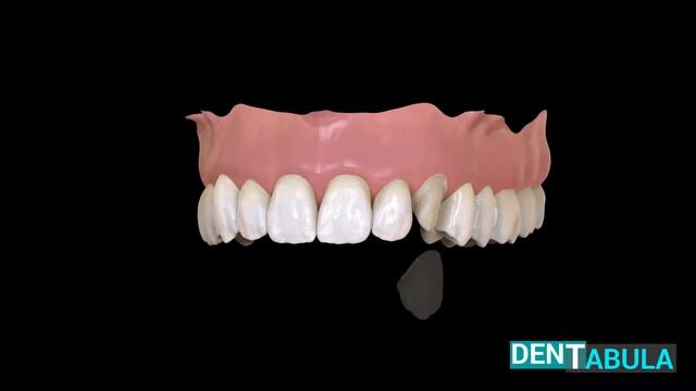 Dentabula 2