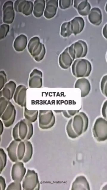 Сколько и какую воду вы пьете?