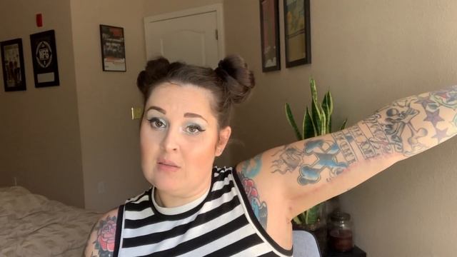 6 MONTH POST OP ARM LIFT (BRACHIOPLASTY)