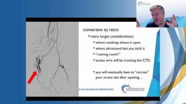 Management of Femoropopliteal and BTK Occlusive Disease CME Webinar