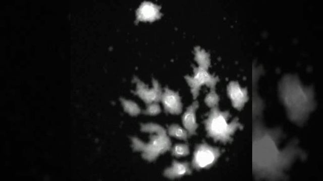 Massive amoebae aggregation and multiple slime molds