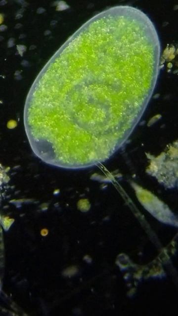 New Green Marvel: Prorodon niveus (Ciliophora) (Form with symbiotic zoochlorellae)