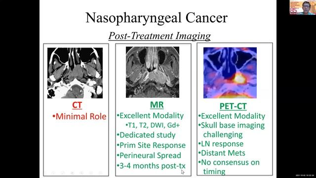 85th AWCS:  The Challenge of Imaging in Recurrent Nasopharyngeal Carcinoma