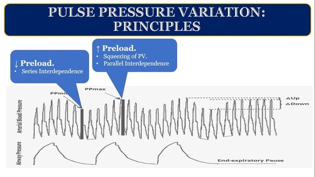 Haemodynamic Monitoring   Beyond Basics HD WEB