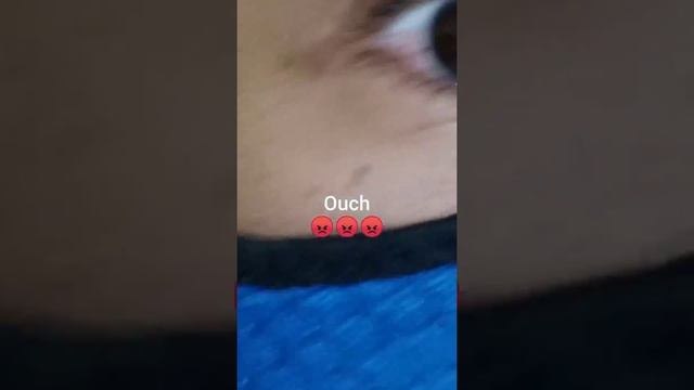 Metal eye dust