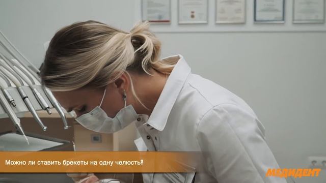 Брекеты часть 4 (на одну челюсть) ортодонт Скакунова Ксения