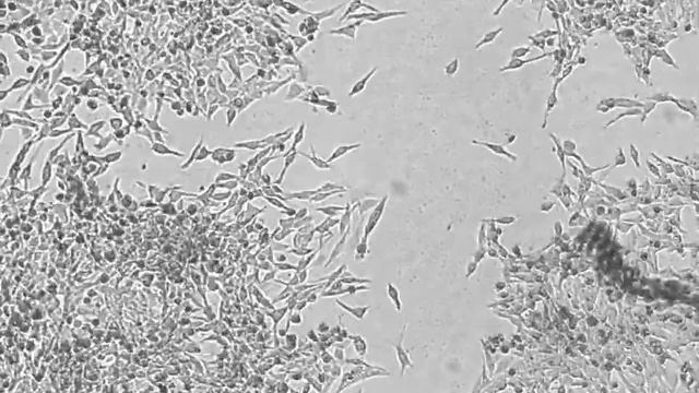 HeLa cells taken with Celloger Mini System for 5 days 90 hours