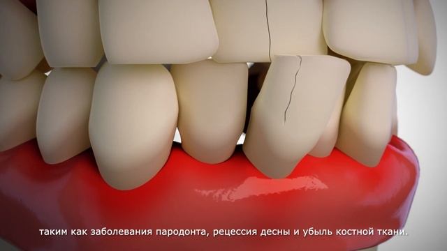 Ваша улыбка уникальна! 
Элайнеры ClearCorrect
