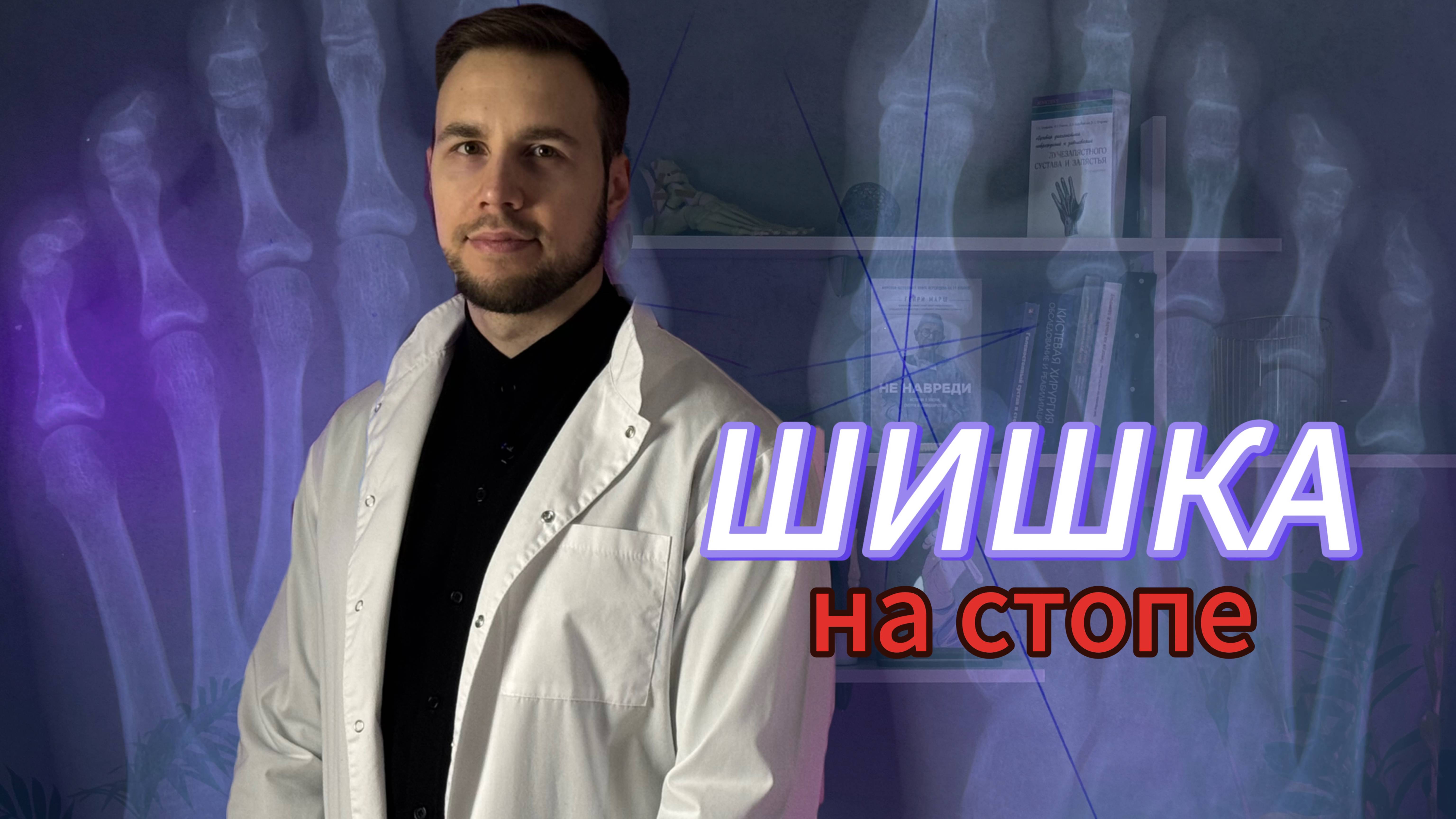 Шишка на стопе? Расскажу что делать, если Вы ее обнаружили.