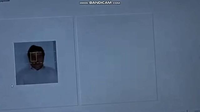 Как будет ставиться начертание лазером на лоб.