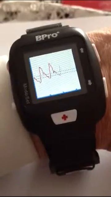 BPro G2 Watch Device for 24 hour ABPM