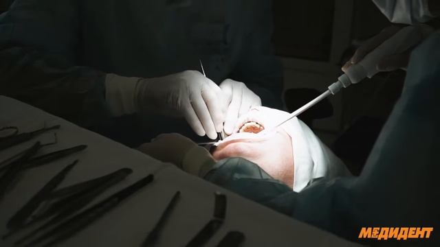 Аналгоседация  и операция имплантация