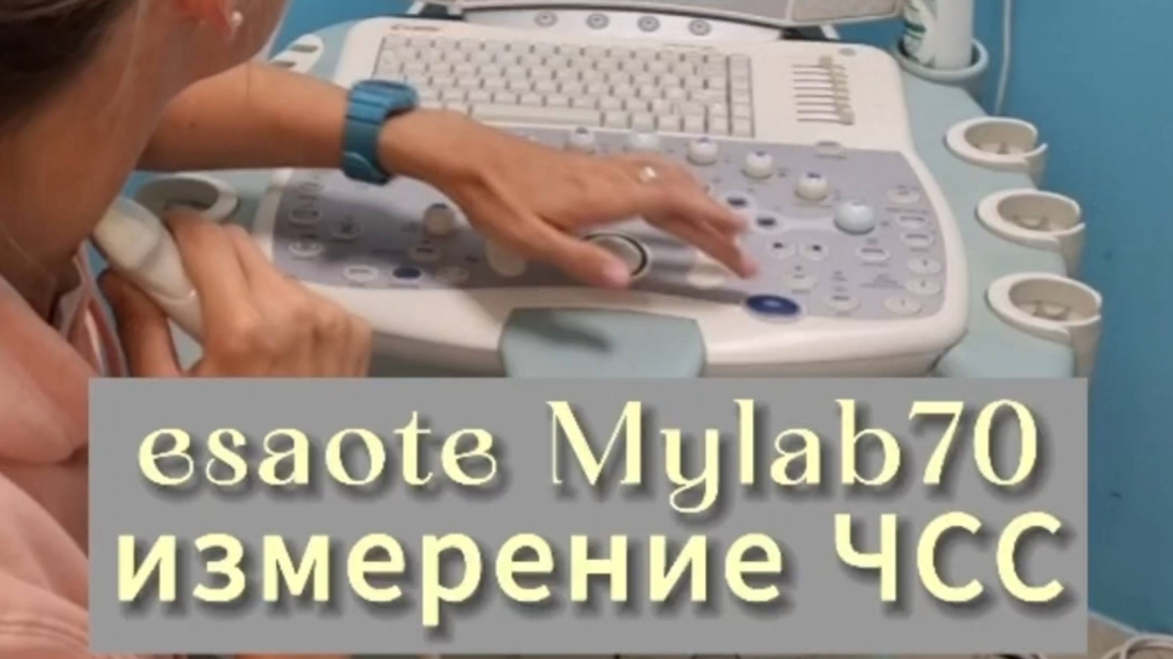 Измерение ЧСС на Узи,
Аппарат Esaote Mylab70