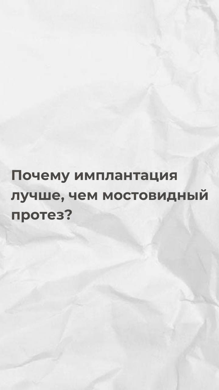 Почему имплантация лучше, чем мост?