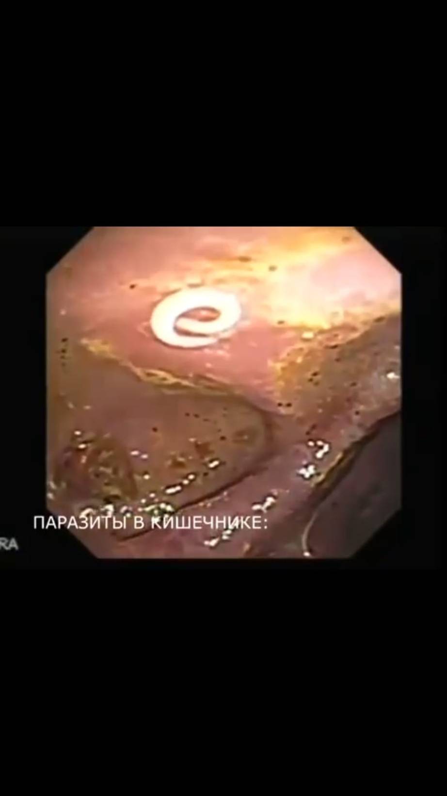 Рак-это паразитоз
