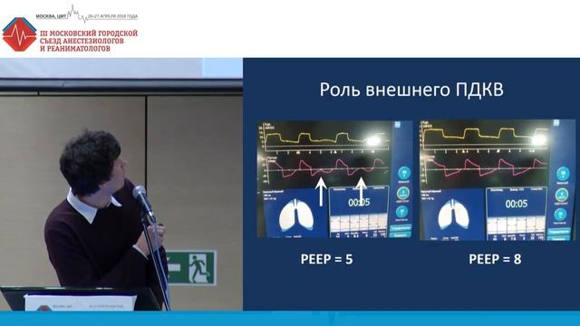 Асинхронии. Практическое применение анализа кривых ИВЛ.Полупан А.А.Савченко Я.В 2018