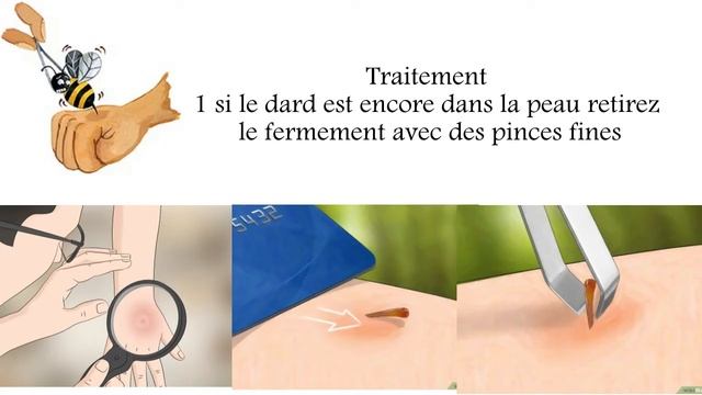 une Piqûre d'Insecte et que Faire Quand ça Arrive
