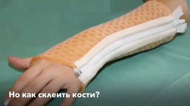 Школьники познают мир!  Медицина. Как «склеить» сломанную кость?