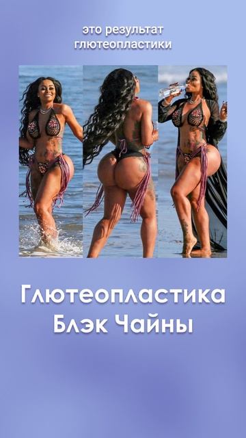 Пластика Блэк Чайны