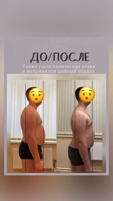 РЕЗУЛЬТАТЫ.До/после