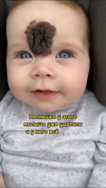 Вы только вглядитесь в пятнышко этого улыбчивого малыша, он как будто помечен Богом