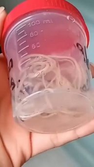 toxocara canis