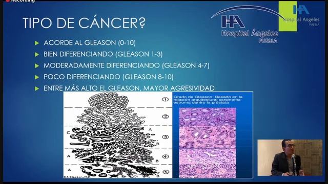 SESIÓN GENERAL “CÁNCER DE PRÓSTATA”